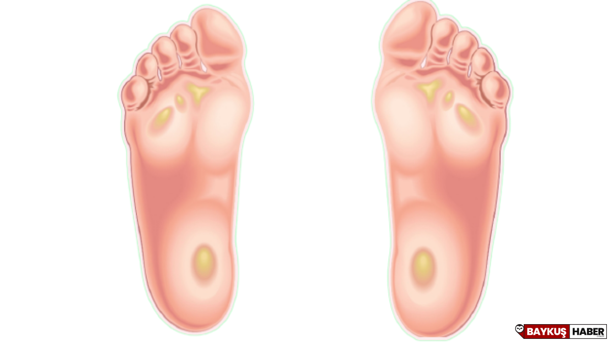 Nasır Hakkında: Neden Oluşur, Tedavisi ve Önleme Yolları