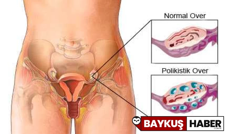 Kanama: Nedenleri, Tedavisi ve Önemli İpuçları
