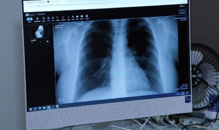 “Afrika sıcaklarıyla akciğer ve alerji hastalıkları da arttı”