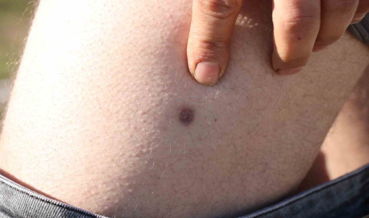 Babadan kalan miras, kardeşi ağabeye vurdurttu