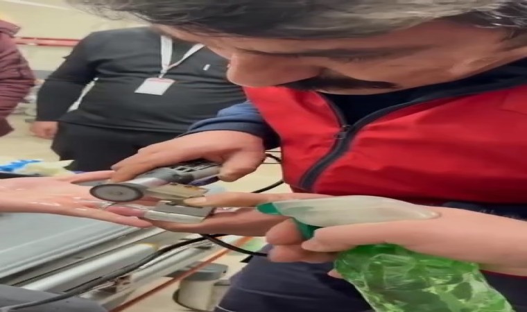 Parmağına sıkışan yüzüğü itfaiye çıkardı