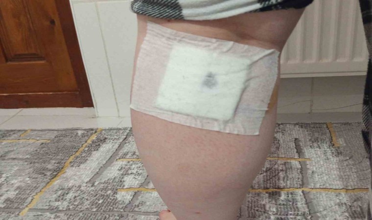 Sokak köpekleri anne ve oğluna saldırdı