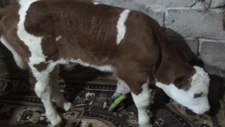 Doğum esnasında ayağı kırıldı, ayağına 6 platin takıldı