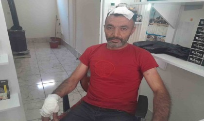 Dükkanının önünü yıkarken başına beton düştü