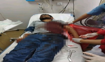 Elektrik sayacı okuyan personele köpek saldırdı