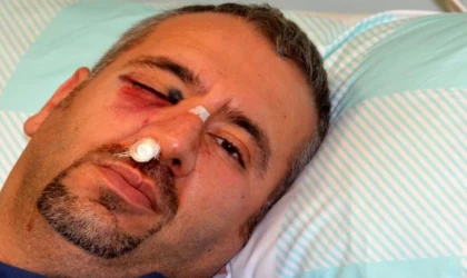 Sağlıkçının elmacık kemiğini kıran hasta yakınına 2 yıl 3 ay hapis