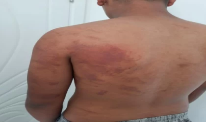 Ahırda zincirli işkence iddiasında, baba, amca ve ağabeye gözaltı