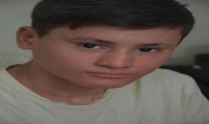 ’Balık pulu’ hastası Kayra, gündüzleri evden çıkamıyor