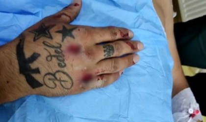 Patnosta ehliyetsiz motosiklet sürücüsü polis aracına çarptı