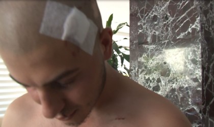 Tur teknesi çalışanı 6 kişi tarafından sopalarla ve demir çubukla dövülen genç İHAya konuştu