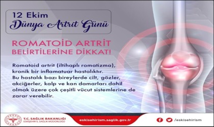 Bilgeden Dünya Artrit Günü açıklaması