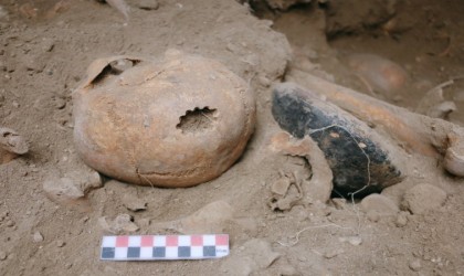 Vanda yeni keşif: 11 delgili bir trepanasyon örneği bulundu