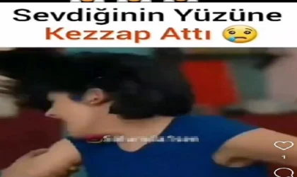 Masaj salonunda kadın çalışanın yüzüne kezzap atan şüpheli yakalandı (2)