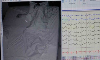 Klinik Nörofizyoloji Uzmanı Leba: Uyku hastalığı kişinin ömrünü kısaltır