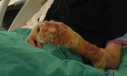 Mangal ateşine dezenfektan döken çift dehşeti yaşadı: Eşim ateşi harlamak istedi, lütfen acele etmeyin