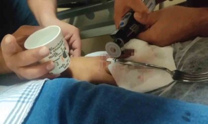 Acil serviste yüzük çıkarma operasyonu