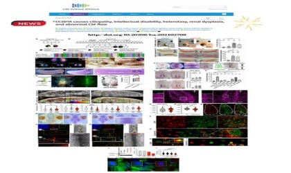 Yeni gen varyantlarının birçok hastalığa sebep olduğu kanıtlandı