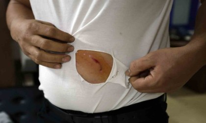 Çerkezköyde fabrika işçisi köpeklerin saldırısından yara bere içinde kurtuldu