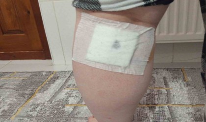 Sokak köpekleri anne ve oğluna saldırdı