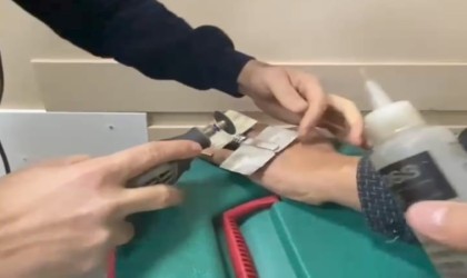 Parmağa sıkışan yüzüğü itfaiye keserek çıkardı