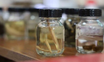 Prof. Dr. Naim Sağlam: Tıbbi sülükler yalnızca uzman kişilerce kullanılmalı