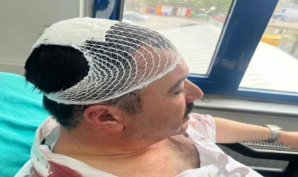 Belediye başkan yardımcısını şekerlikle yaralayan YRP’li başkan yardımcısı tutuklandı