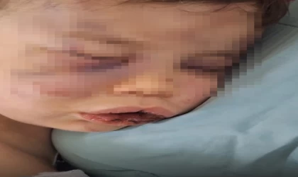 Vahşeti yaşayan 2 yaşındaki bebek hastanelik oldu