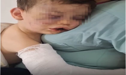 Darp sonucu hastanelik olan bebek devlet korumasına alınacak