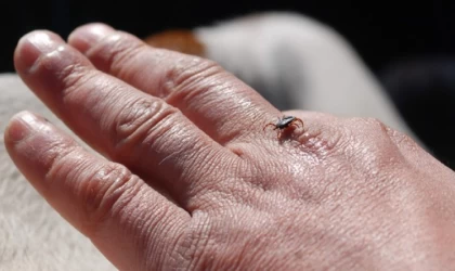 Uzmanlar; ”Kene ısırığına dikkat”